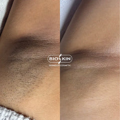 BSK204-web - Aura Aesthetics Care